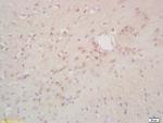 Phospho-NK (Thr234) Antibody in Immunohistochemistry (Paraffin) (IHC (P))