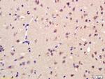 AKR1A1 Antibody in Immunohistochemistry (Paraffin) (IHC (P))