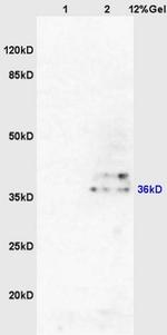 AKR1A1 Antibody in Western Blot (WB)