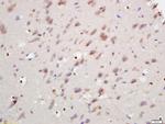 ANKRD9 Antibody in Immunohistochemistry (Paraffin) (IHC (P))