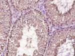 ARMC3 Antibody in Immunohistochemistry (Paraffin) (IHC (P))