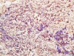 BTBD7 Antibody in Immunohistochemistry (Paraffin) (IHC (P))