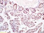 CCDC7 Antibody in Immunohistochemistry (Paraffin) (IHC (P))