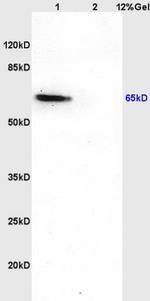CDKAL1 Antibody in Western Blot (WB)