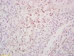 Phospho-DDX5 (Tyr593) Antibody in Immunohistochemistry (Paraffin) (IHC (P))