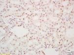Phospho-DDX5 (Tyr593) Antibody in Immunohistochemistry (Paraffin) (IHC (P))