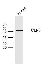 CLN3 Antibody in Western Blot (WB)