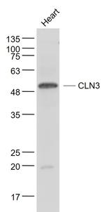 CLN3 Antibody in Western Blot (WB)