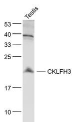 CKLFH3 Antibody in Western Blot (WB)