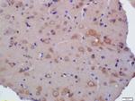 KLHL24 Antibody in Immunohistochemistry (Paraffin) (IHC (P))