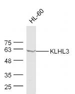 KLHL3 Antibody in Western Blot (WB)