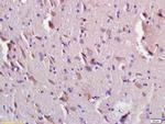 CEMIP Antibody in Immunohistochemistry (Paraffin) (IHC (P))