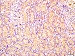 CEMIP Antibody in Immunohistochemistry (Paraffin) (IHC (P))