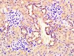 CEMIP Antibody in Immunohistochemistry (Paraffin) (IHC (P))