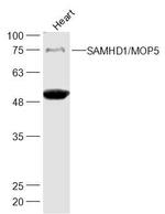 SAMHD1 Antibody in Western Blot (WB)