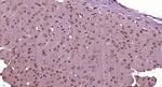 SRRM4 Antibody in Immunohistochemistry (Paraffin) (IHC (P))
