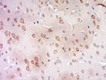 CCDC94 Antibody in Immunohistochemistry (Paraffin) (IHC (P))