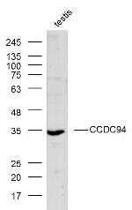 CCDC94 Antibody in Western Blot (WB)