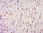 CCDC124 Antibody in Immunohistochemistry (Paraffin) (IHC (P))