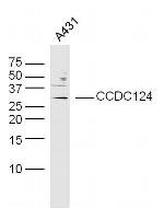 CCDC124 Antibody in Western Blot (WB)