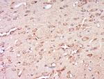 CCDC82 Antibody in Immunohistochemistry (Paraffin) (IHC (P))