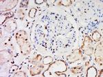 CCDC30 Antibody in Immunohistochemistry (Paraffin) (IHC (P))