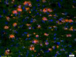 CCDC12 Antibody in Immunohistochemistry (Paraffin) (IHC (P))