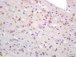 CCDC12 Antibody in Immunohistochemistry (Paraffin) (IHC (P))