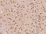 CCDC42 Antibody in Immunohistochemistry (Paraffin) (IHC (P))