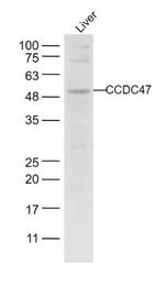 CCDC47 Antibody in Western Blot (WB)