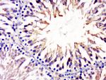 CCDC54 Antibody in Immunohistochemistry (Paraffin) (IHC (P))