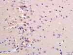 CCDC61 Antibody in Immunohistochemistry (Paraffin) (IHC (P))