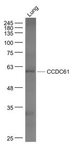 CCDC61 Antibody in Western Blot (WB)