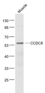 CCDC8 Antibody in Western Blot (WB)