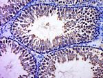 CCDC93 Antibody in Immunohistochemistry (Paraffin) (IHC (P))