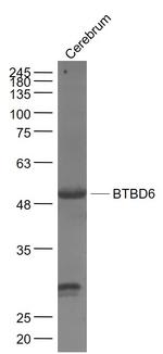 BTBD6 Antibody in Western Blot (WB)