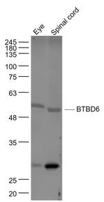 BTBD6 Antibody in Western Blot (WB)