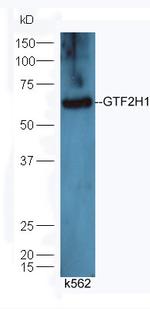 GTF2H1 Antibody in Western Blot (WB)