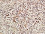 K11 Antibody in Immunohistochemistry (Paraffin) (IHC (P))