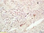 K11 Antibody in Immunohistochemistry (Paraffin) (IHC (P))