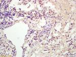 K11 Antibody in Immunohistochemistry (Paraffin) (IHC (P))