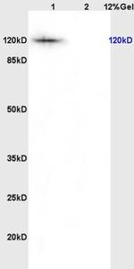 K11 Antibody in Western Blot (WB)