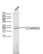 COMMD8 Antibody in Western Blot (WB)