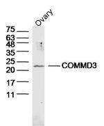 COMMD3 Antibody in Western Blot (WB)