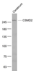 CSMD2 Antibody in Western Blot (WB)
