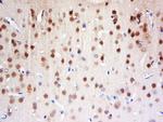 FAM13C1 Antibody in Immunohistochemistry (Paraffin) (IHC (P))