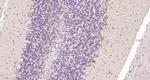 FRMD4B Antibody in Immunohistochemistry (Paraffin) (IHC (P))