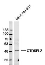 CTDSPL2 Antibody in Western Blot (WB)