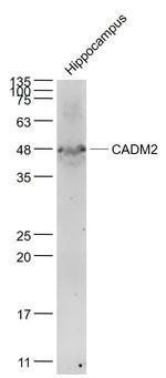 CADM2 Antibody in Western Blot (WB)