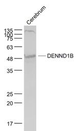 DENND1B Antibody in Western Blot (WB)